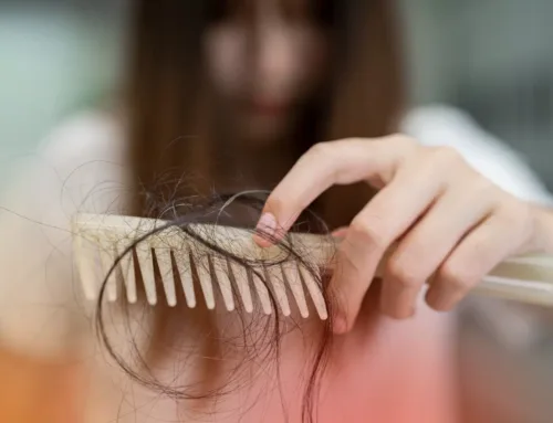 Hair Loss & Hormone Support: Navigating Treatments When Seasonal Stress Triggers Shedding